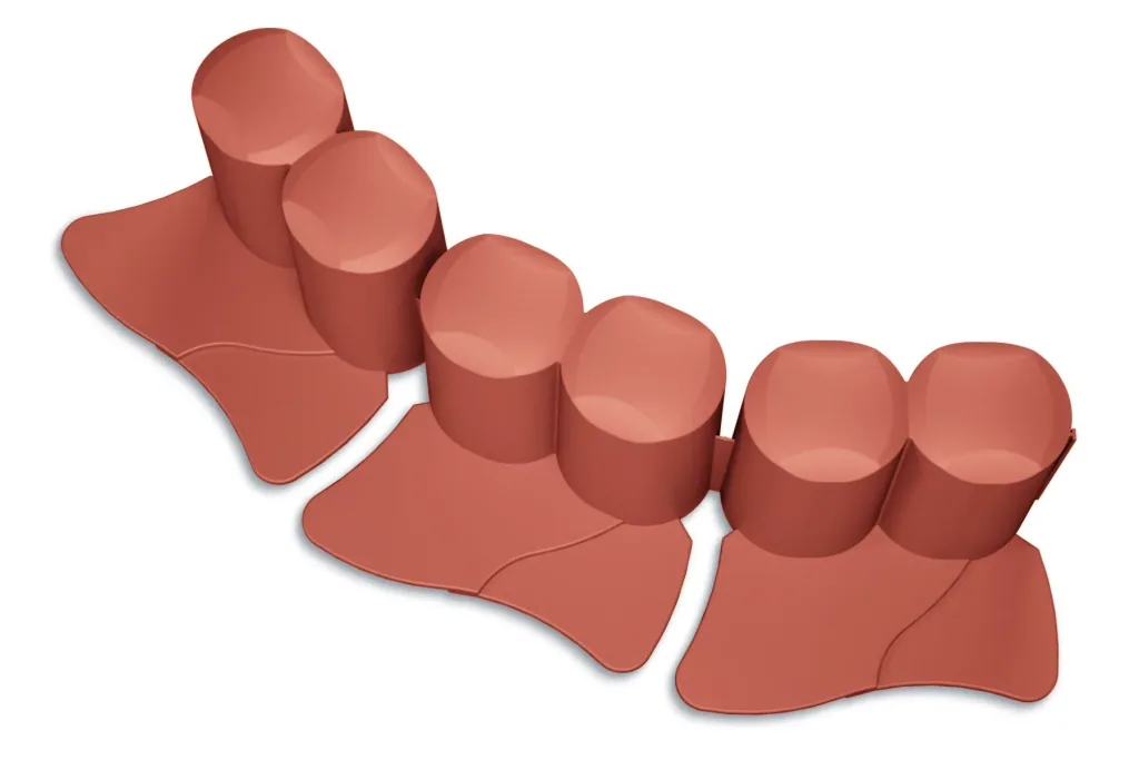 Bed edging PALISADE, terracotta - 8 pieces - 3.02 m